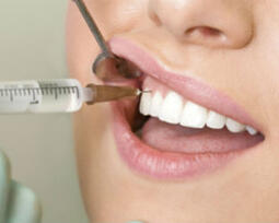 Все об имплантации зубов