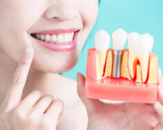 Имплантация жевательных зубов на нижней челюсти